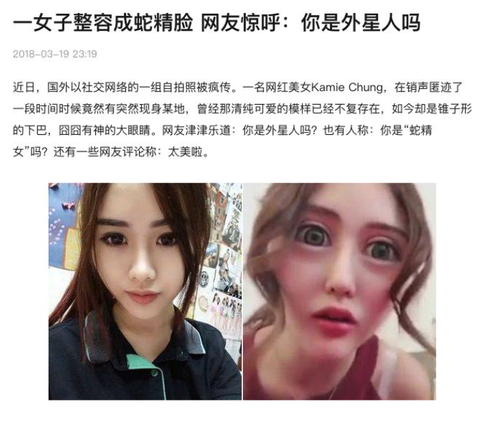 容貌焦慮是病嗎？